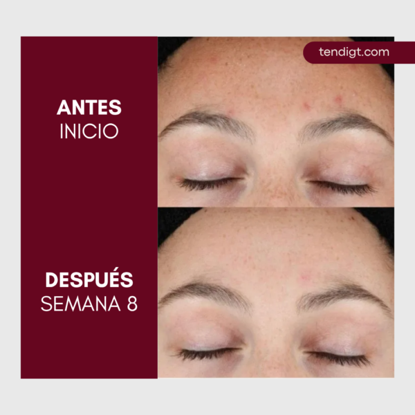 113 Cerave | Sérum Retinol Anti-marcas 30ml