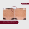 ISDIN | Isdinceutics Glicoisdin 15 | 50ml